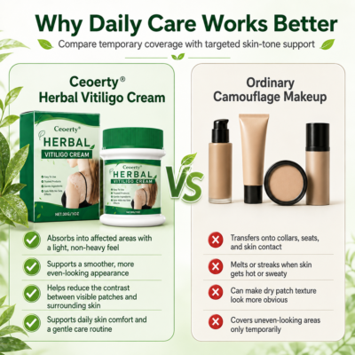 Ceoerty® botanical vitiligo cream with aloe vera and licorice root