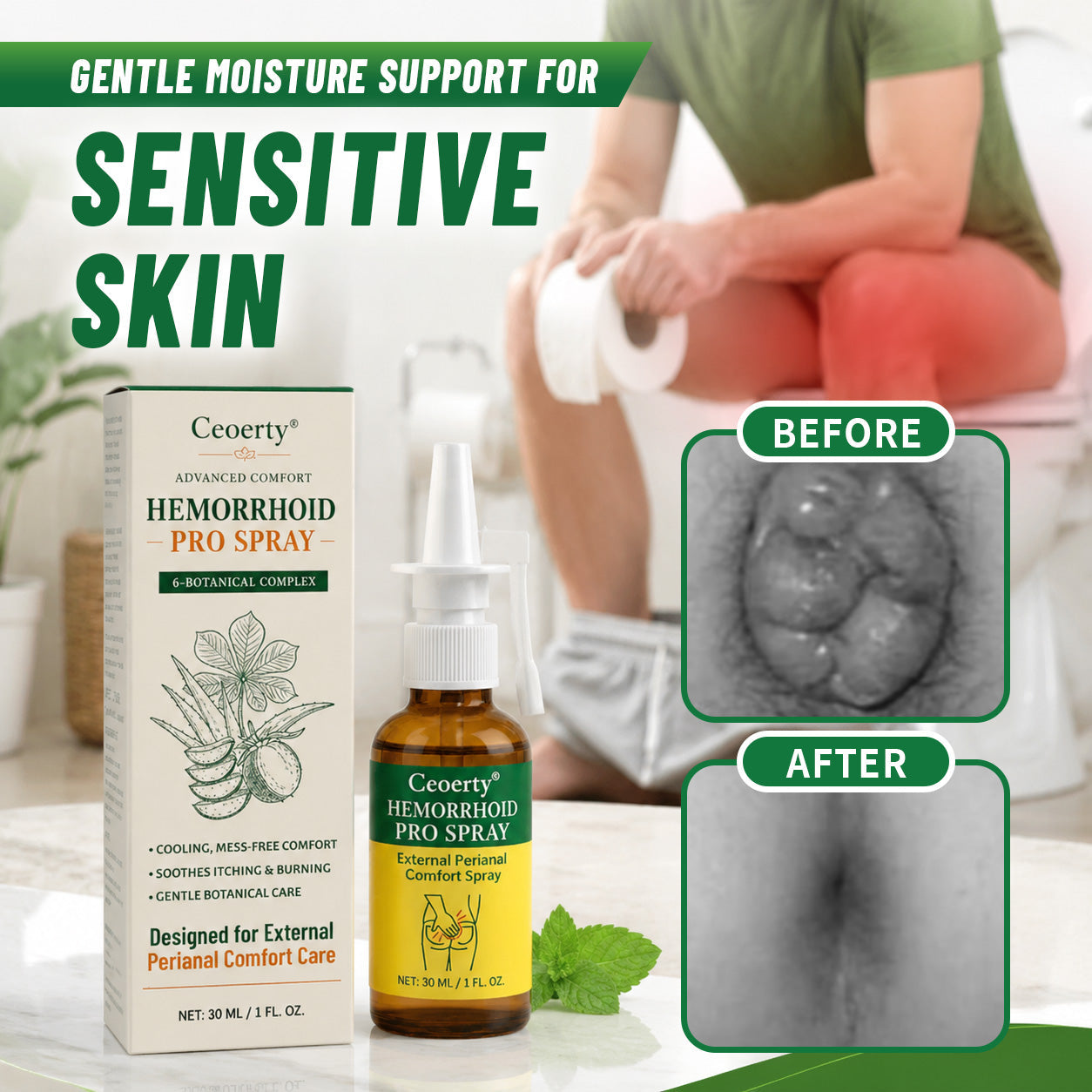 Ceoerty® cooling external care spray with horse chestnut and bioflavonoids